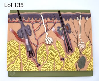Vintage Somso Section of Skin Anatomical Model