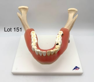 3B Scientific D26 Dental Disease Model