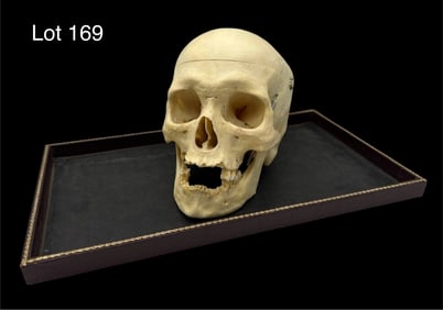 Authentic Human Skull with Cut Calvarium