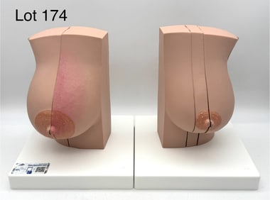 3B Scientific Model of Female Breast with Healthy & Unhealthy Tissue