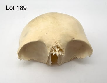 Authentic Human Pediatric Frontal Bone Skull