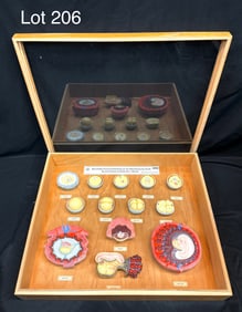 Vintage Somso 13 Piece Model of Human Development From Fertilization Up to the Embryo at the End of