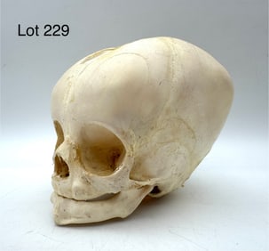Authentic Pediatric Human Fetal Skull, 3 Months