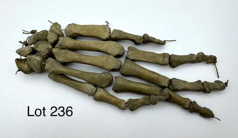 Antique Authentic Human Hand Skeleton