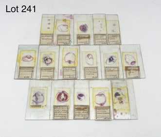 Group of Early 20th Century Microscope Slides From Royal Eye Hospital