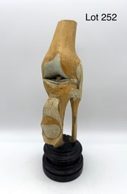Vintage Anatomical Model of a Knee