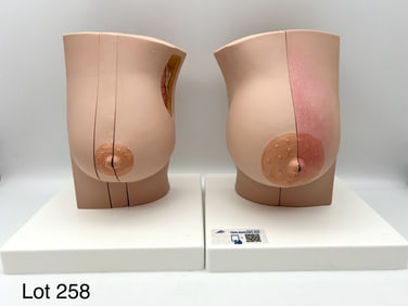Model of Female Breast with Healthy & Unhealthy Tissue, New