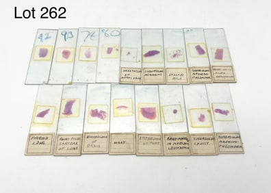Group of Early 20th Century Microscope Slides Relating To Maladies of The Human Body Including