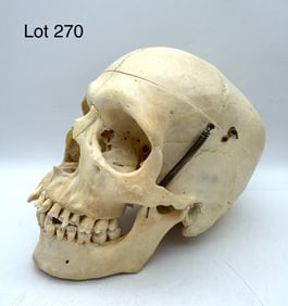 Authentic Human Skull w/ Cut Calvarium and Metopic Suture