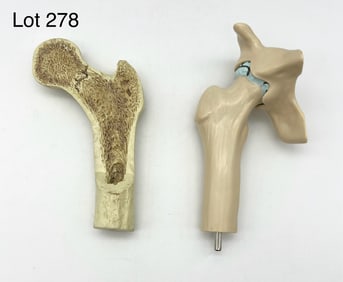Pair of Femur Models Including Pathology