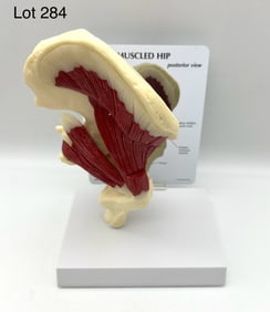 GPI Muscled Hip Joint – Model #1310 Anatomical Model