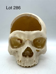 Authentic Cut Human Skull