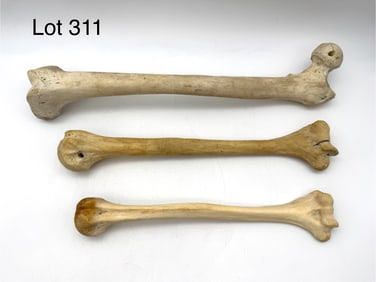 Authentic Human Femur and Humerus Bones