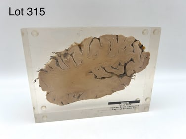 Carolina Biological Real Human Brain Section in Acrylic