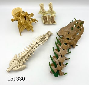 Vintage Anatomical Spine Models