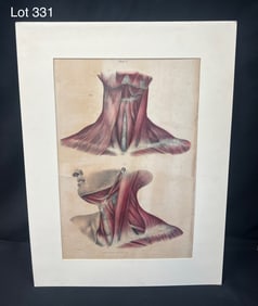 Vintage Scientific Print of Muscles of the Neck