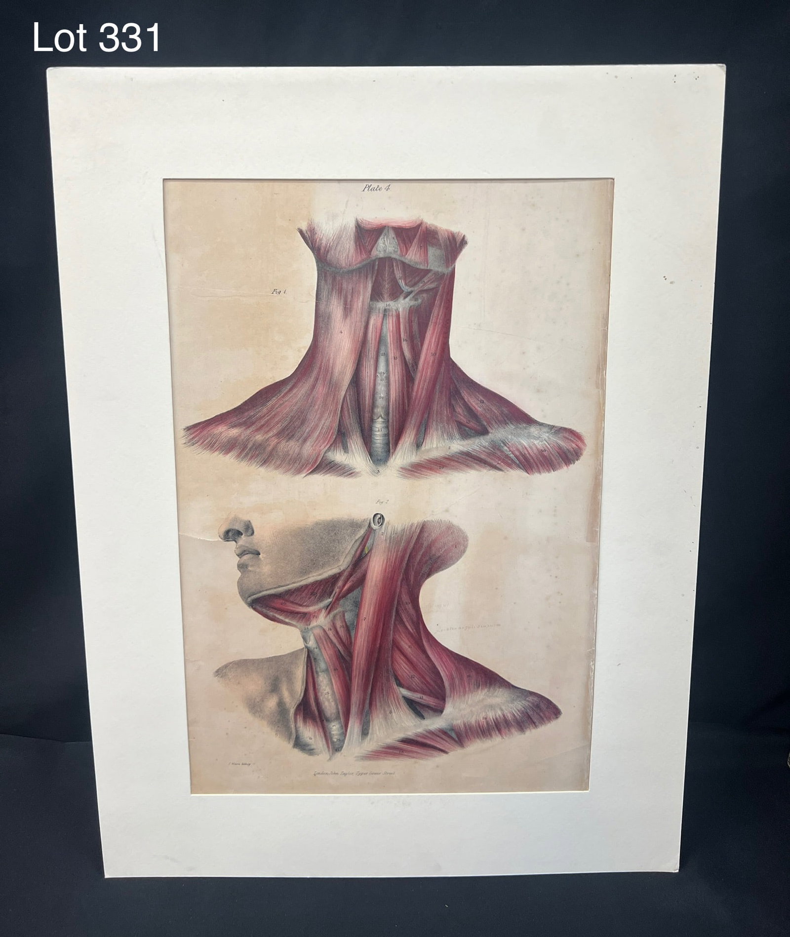 Vintage Scientific Print of Muscles of the Neck: A vintage scientific print of the muscles of the neck showing both the anterior and lateral views. 20" 12 1/2". Marked "J. Walsh lithog/London, John Taylor, Upper Gower Street". *notes- tear on left m