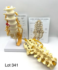 Two Vintage Lumbar Vertebrae With Sacrum Anatomy Models