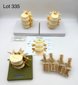 Four Vintage Anatomical Models of Spine Vertebrae
