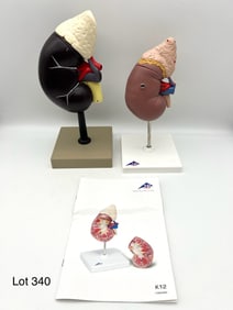 Two Vintage Anatomical Models of Kidneys