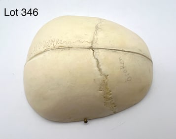 Authentic Upper Cranium Section Of A Human Skull