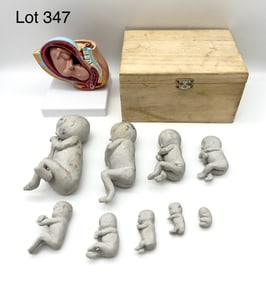 Vintage Anatomical Model of Female Pregnancy Pelvic Cavity and Fetus Models