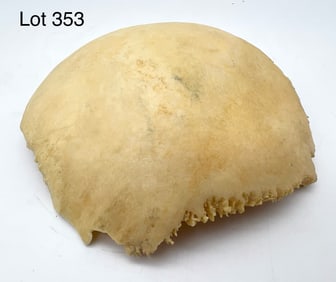 Authentic Human Parietal Bone