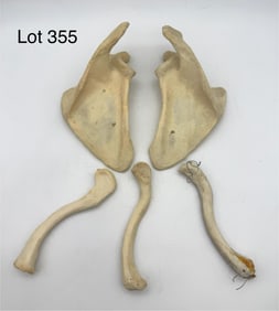 Lot of Human Bones Feat. Scapula & Clavicle