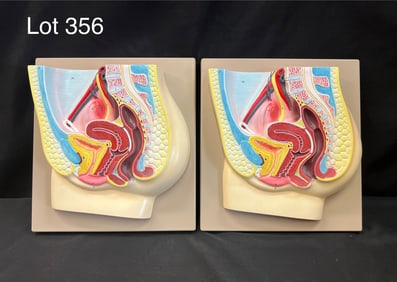 Duo of Eisco Female Reproductive System (AM0116A) Anatomical Models