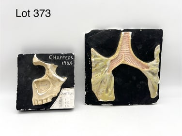 Two Antique Anatomical Plaster Models