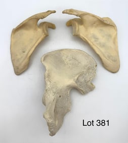 Trio of Human Bones, 2 Scapula and 1 Ilium