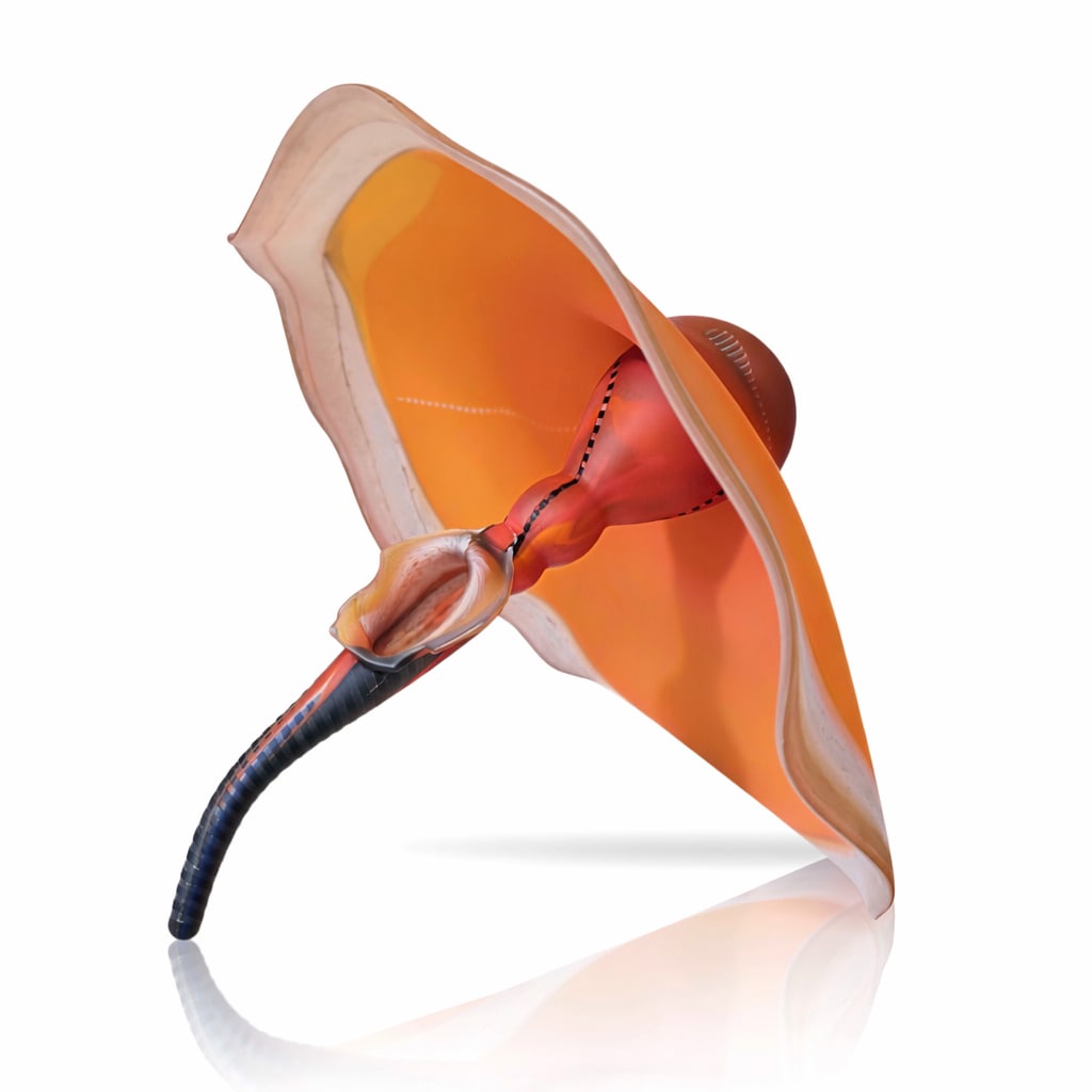 Stephen Dee Edwards Physalia Art Glass: -- View a short video of this work: https://www.youtube.com/watch?v=dsznhsq-TVU Artist name: Stephen Dee Edwards Country of origin: United States Title of the work: Physalia Year: 1982 Dimensions: 12