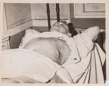 AN ORIGINAL PRESS PHOTO OF DUTCH SCHULTZ IN THE HOSPITAL AFTER BEING SHOT. October 23, 1935. An (1 of 1)