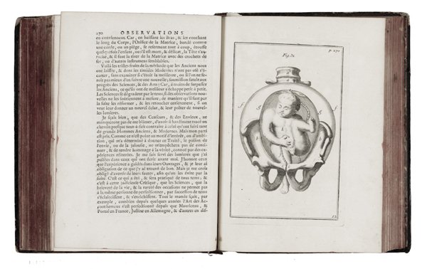 Deventer Hendrik van: Deventer Hendrik van, Observations importantes sur le manuel des accouchemens. Première partie (-seconde)... Traduite du Latin de M. Henry de Deuenter, docteur en medicine, & augmenté de Reflexions 