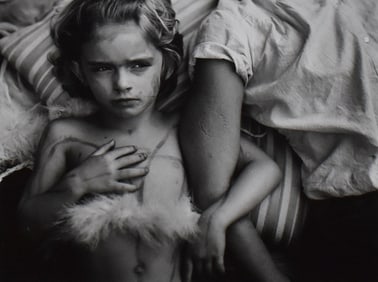 Sally Mann: Jessie Bites, 1985