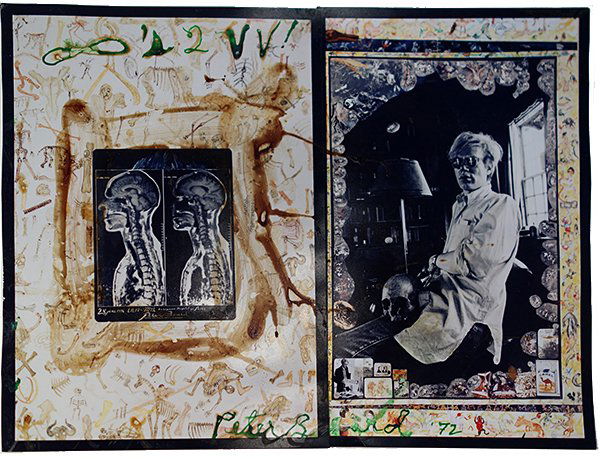 Peter Beard , MRI/Warhol with Skull: (Memento Photograph), 1972 Fujichrome color photographs, blood and ink Signed and dated in ink on recto Image: 10 x 13 inches; Framed: 12.75 x 16.25 inches