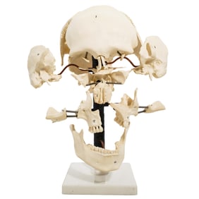 Anatomical 'Exploded' Skull Model