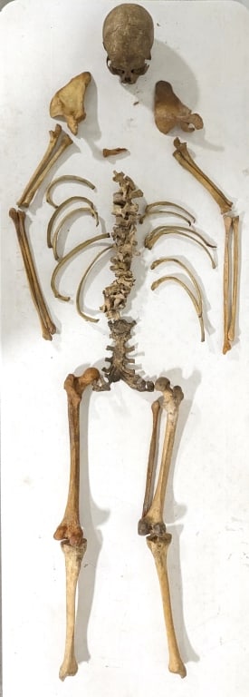 Antique Masons / Odd Fellows Human Skeleton (1 of 11)