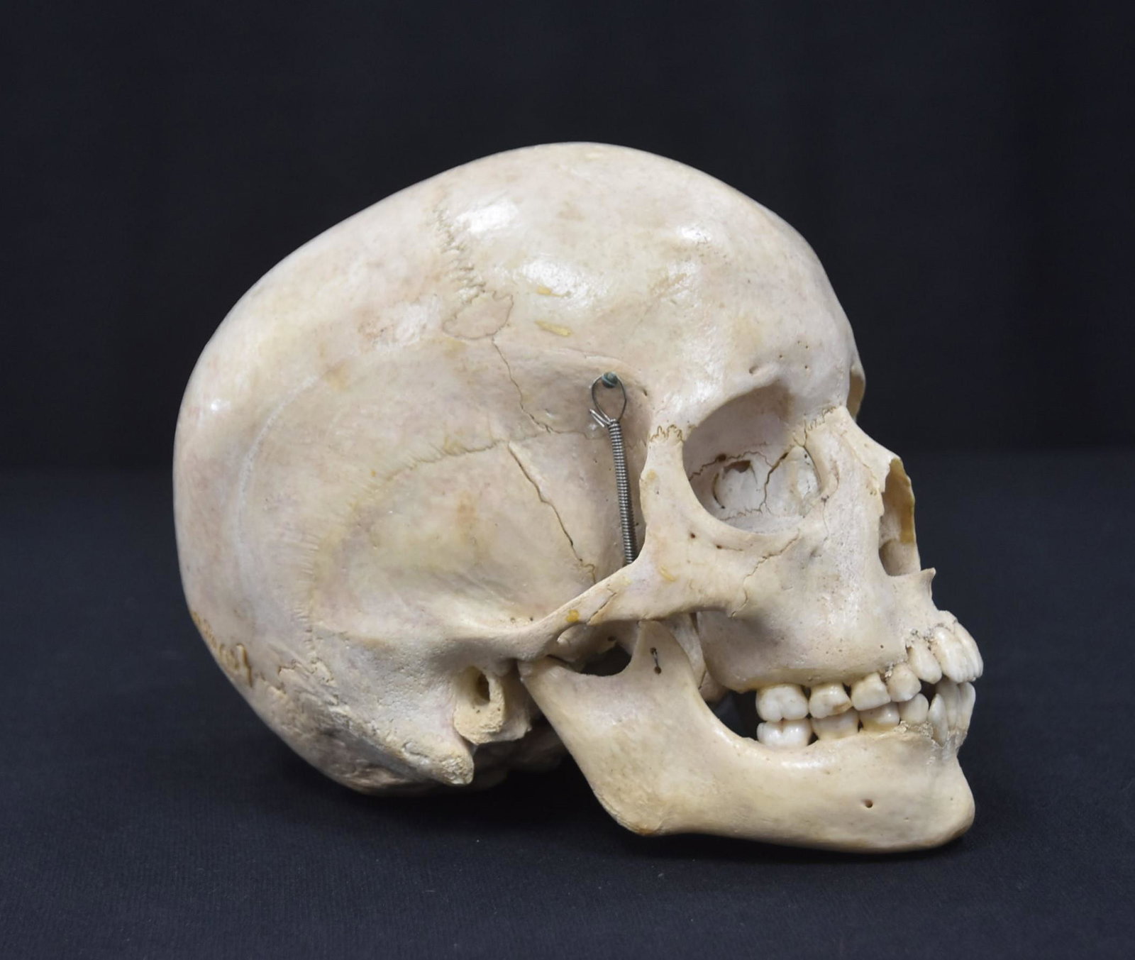 ARTICULATED MEDICAL DENTAL SKULL (1 of 14)