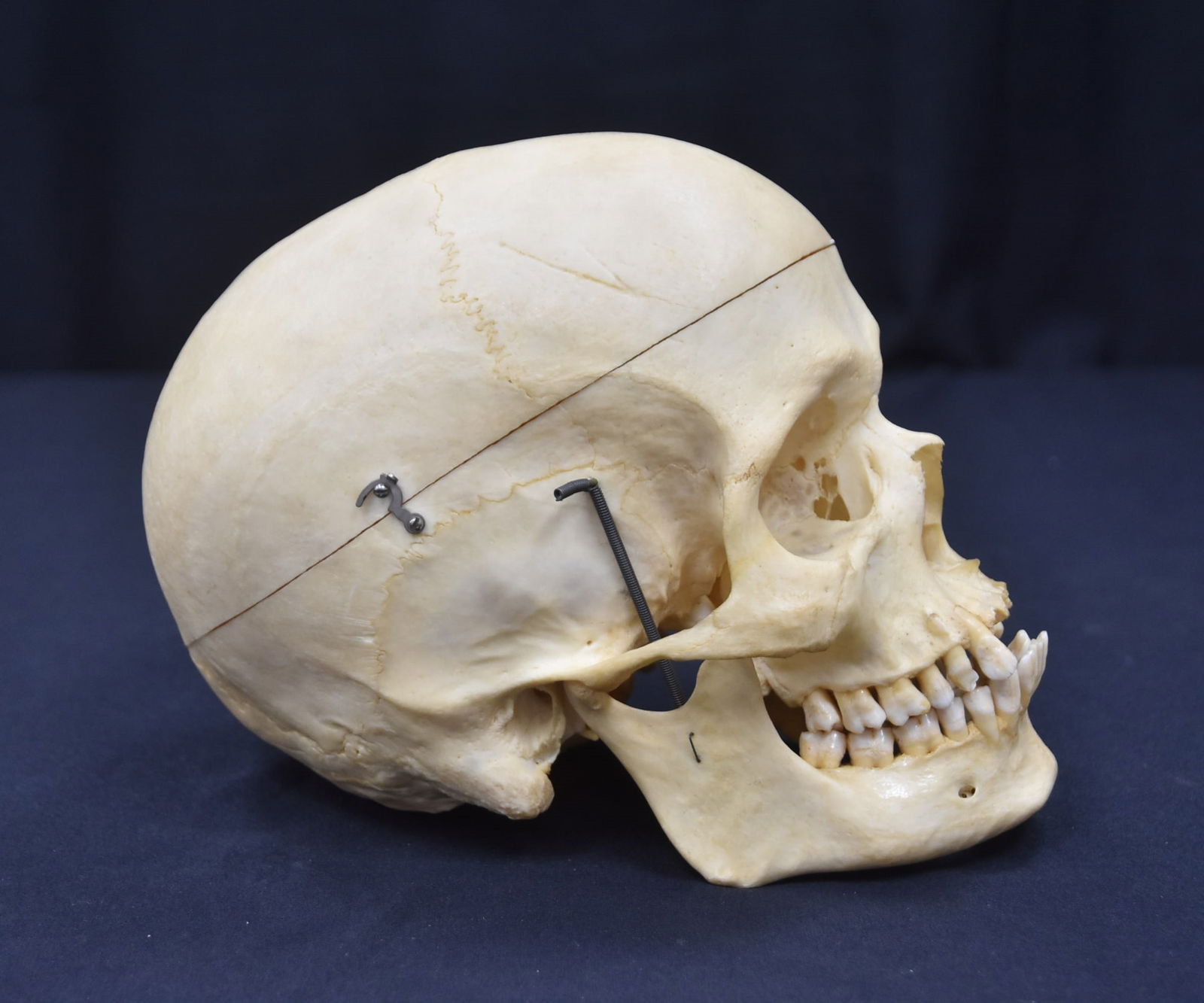 FULLY ARTICULATED MEDICAL SKULL (1 of 20)