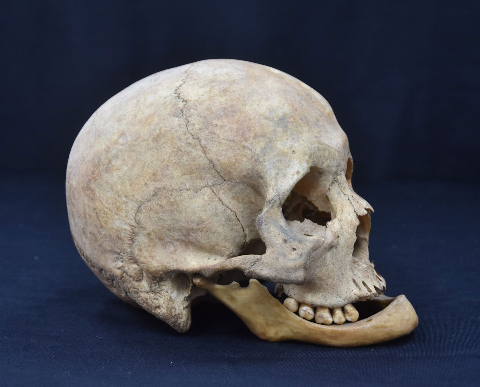 ANTIQUE 19thC ? HUMAN SKULL (1 of 15)