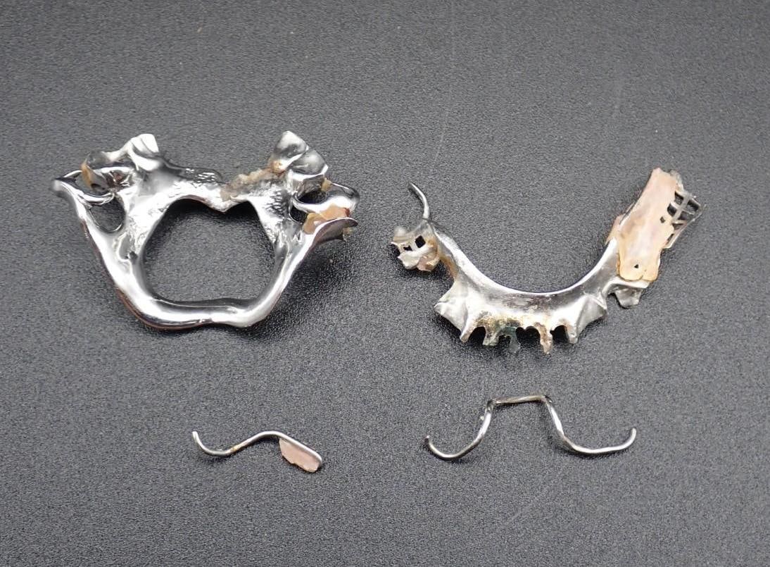 12 Grams +/- of Dental Metal: acid tests platinum