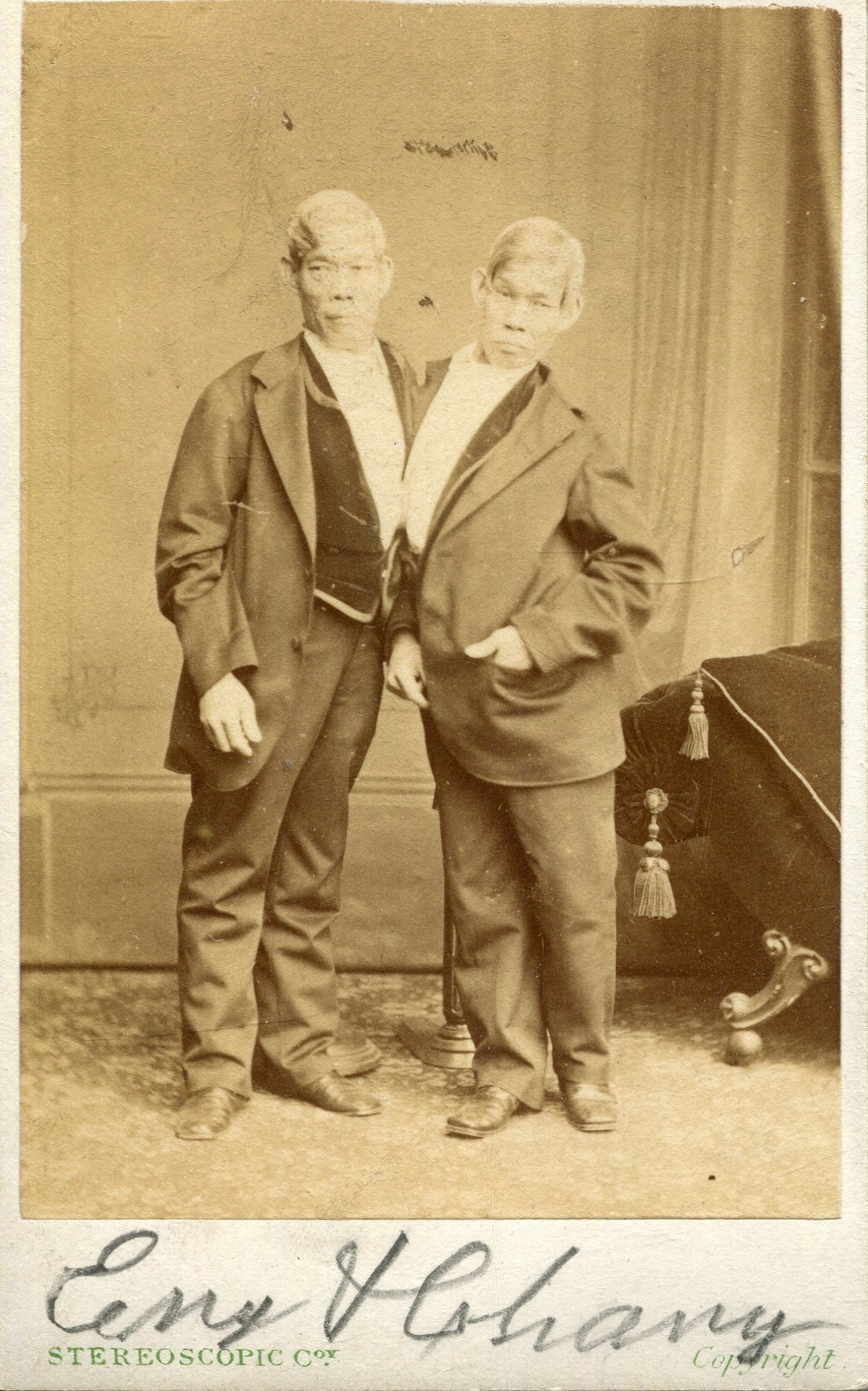BUNKER CHANG & ENG: (1811-1874) (1 of 2)