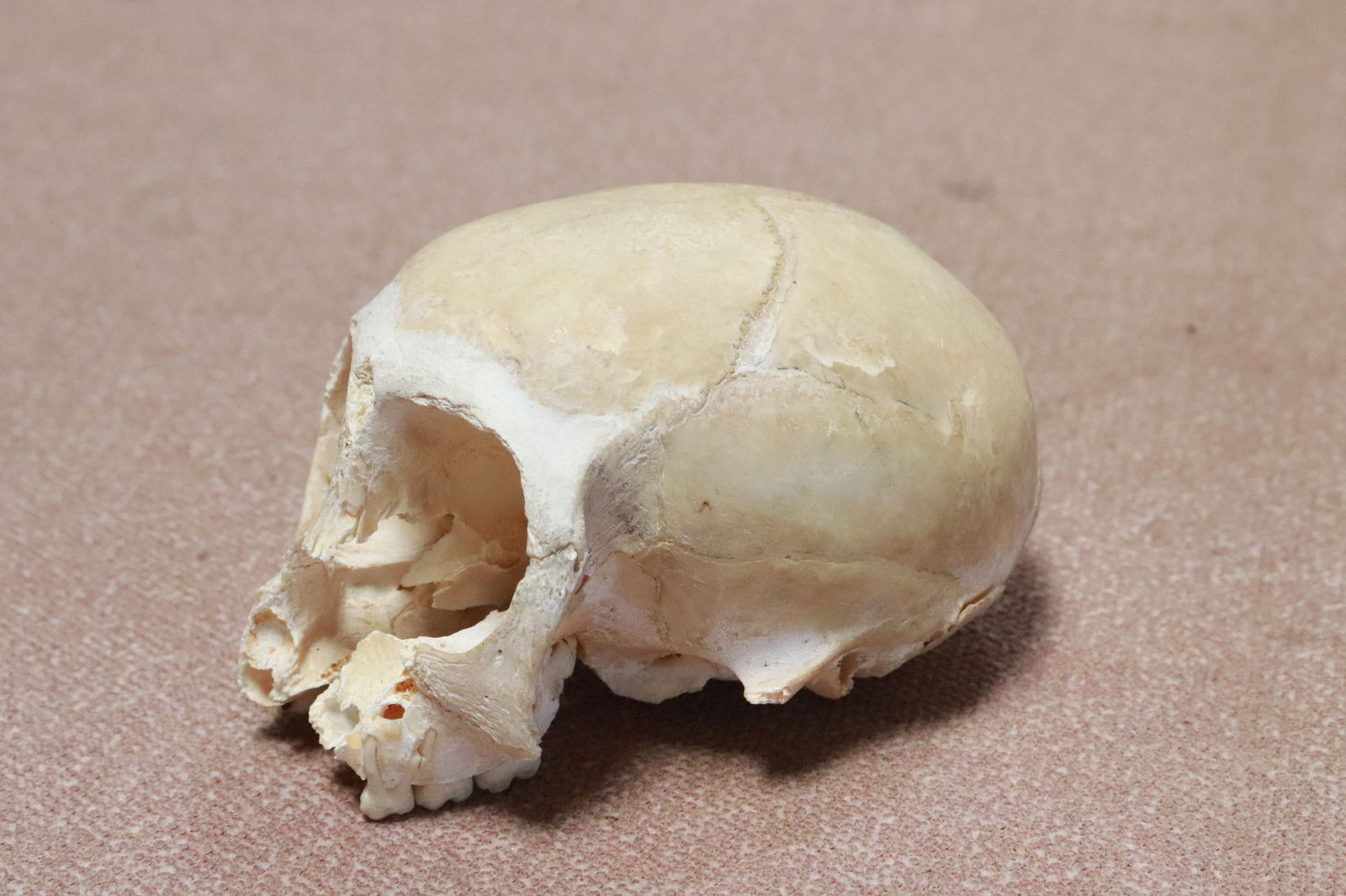 A genuine skull, losses - 3