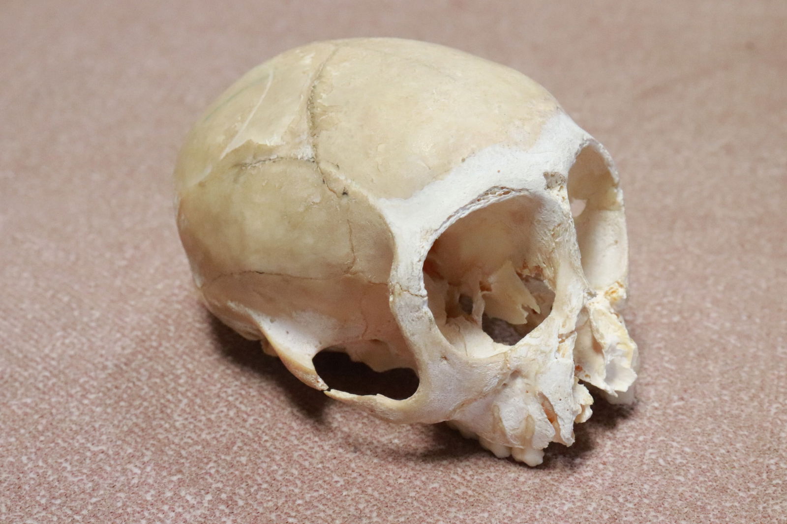 A genuine skull, losses - 5