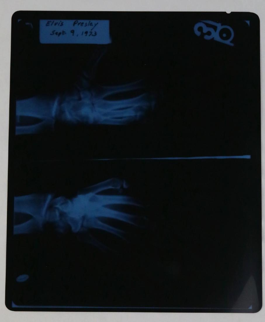 Elvis Presley 1973 Wrist X-Ray Negative W/LOA (1 of 6)