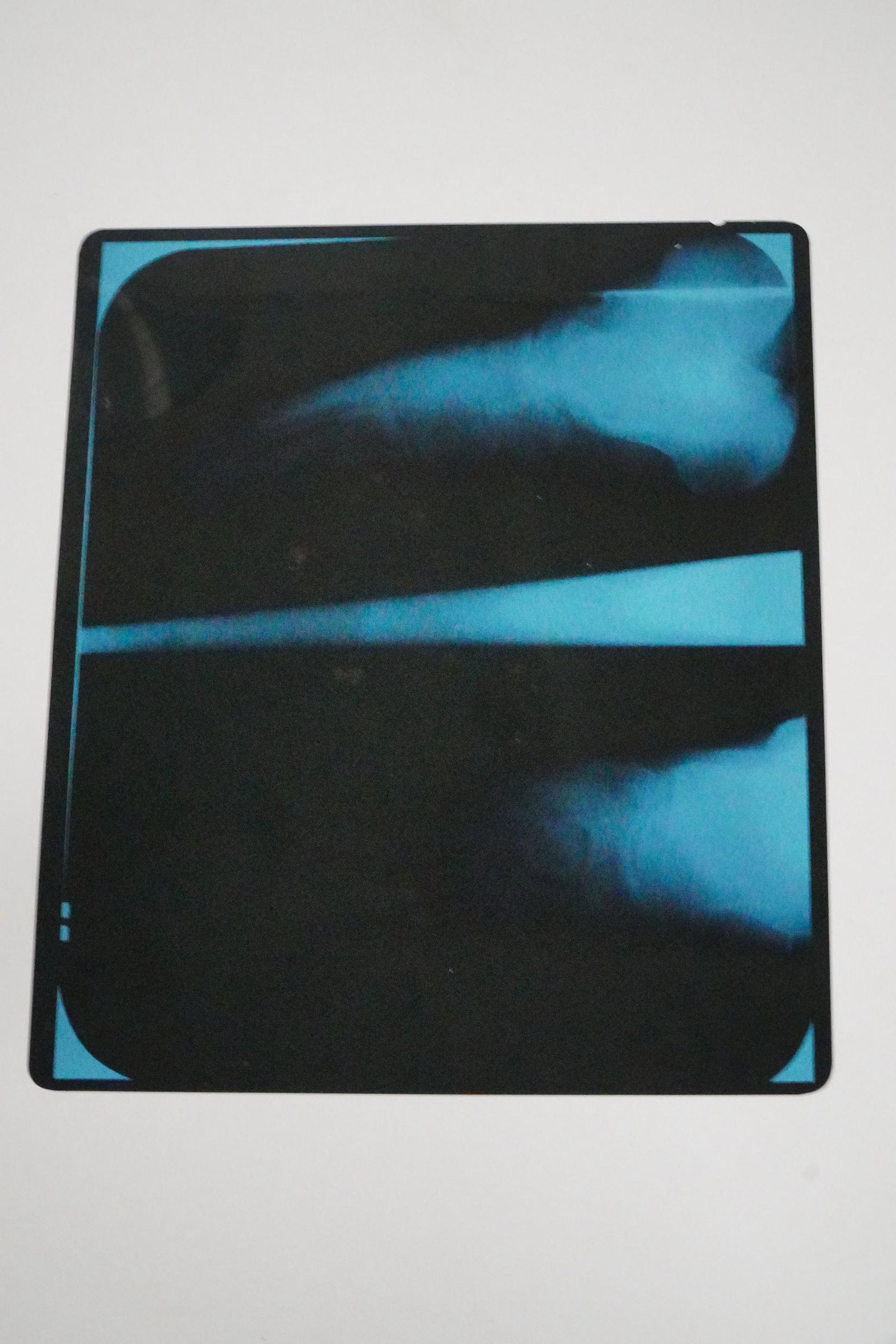 Elvis Presley Foot X-Ray Taken by Dr. Donald Draper (1 of 3)