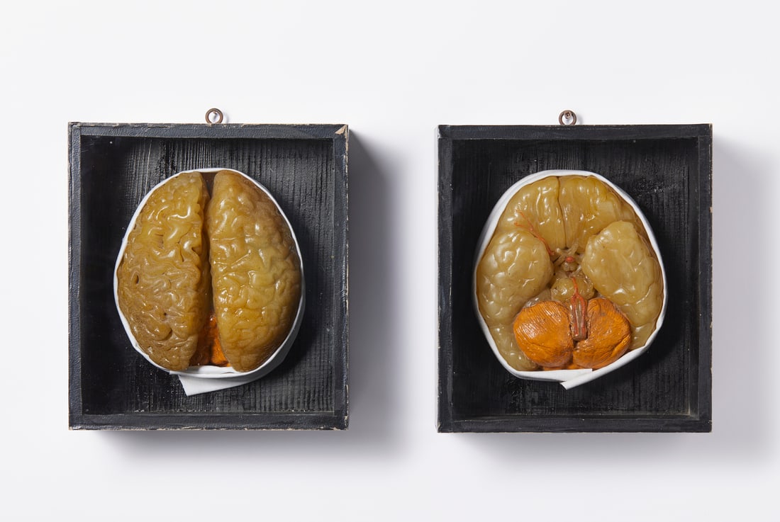 TWO WAX MODELS DEPICTING A DISSECTED HUMAN BRAIN IN WOODEN CASES Italy, early 20th century . (1 of 3)