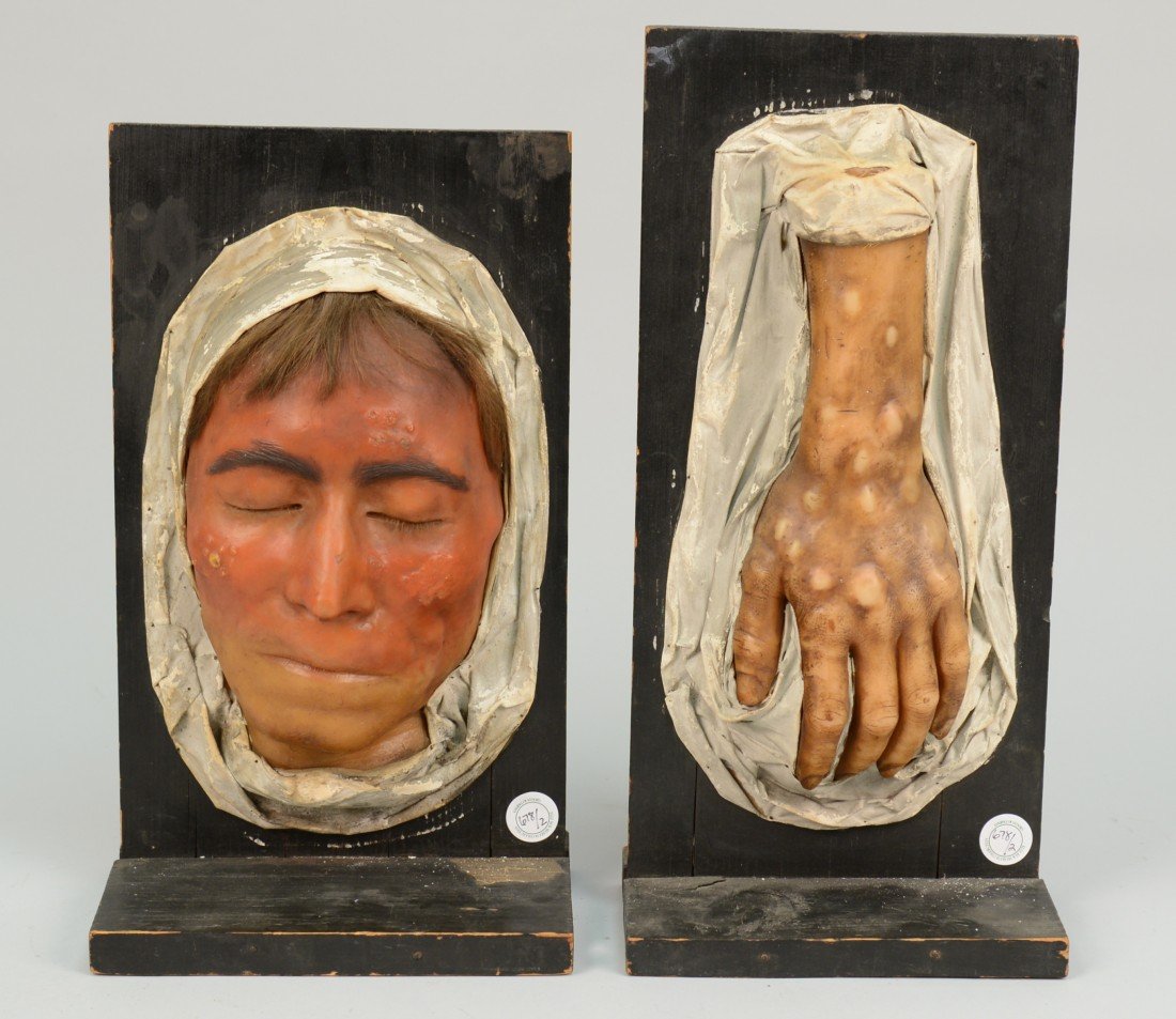 MEDICAL DEATH MASK, together with a WAX HAND: MEDICAL DEATH MASK, together with a WAX HAND