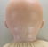 PAIR OF ANTIQUE BISQUE HEAD CHARACTER BABY DOLLS. - 3